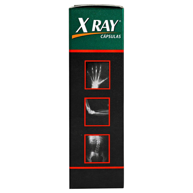 X-Ray 450Mg/30Mg/10Mg Con 40 Capsulas (Glucosamina/Vitamina Con Condroitina) - WeCare Pharma