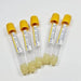Tubo Vacutainer Amarillo Con 100 - WeCare Pharma